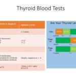 TSH with Reflex to FT4