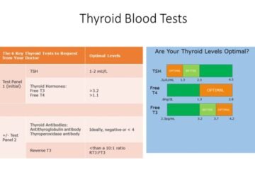 TSH with Reflex to FT4