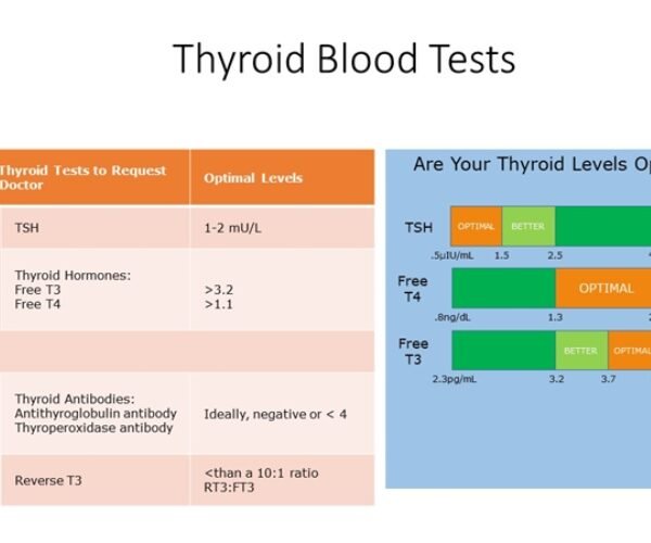 TSH with Reflex to FT4